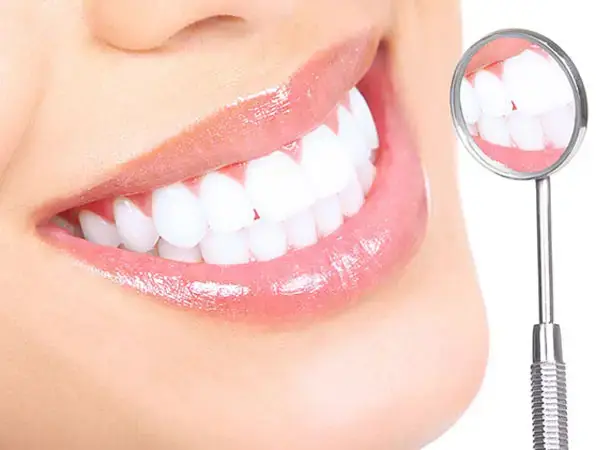 Zahnaufhellung Wien – professionelles Bleaching bei Dentalaesthetics, 1010 Wien