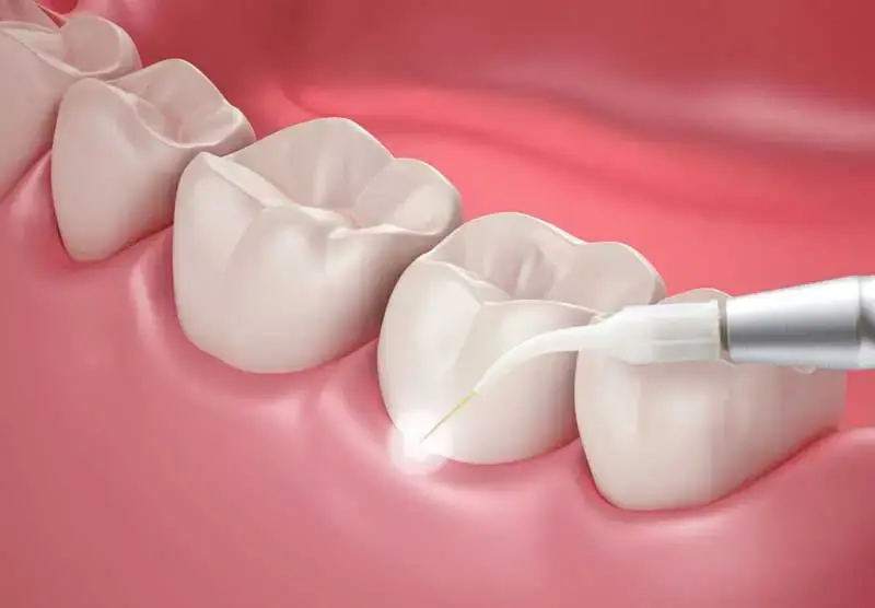 Laserzahnheilkunde Wien – schonende Laserbehandlung bei Dentalaesthetics 1010 Wien